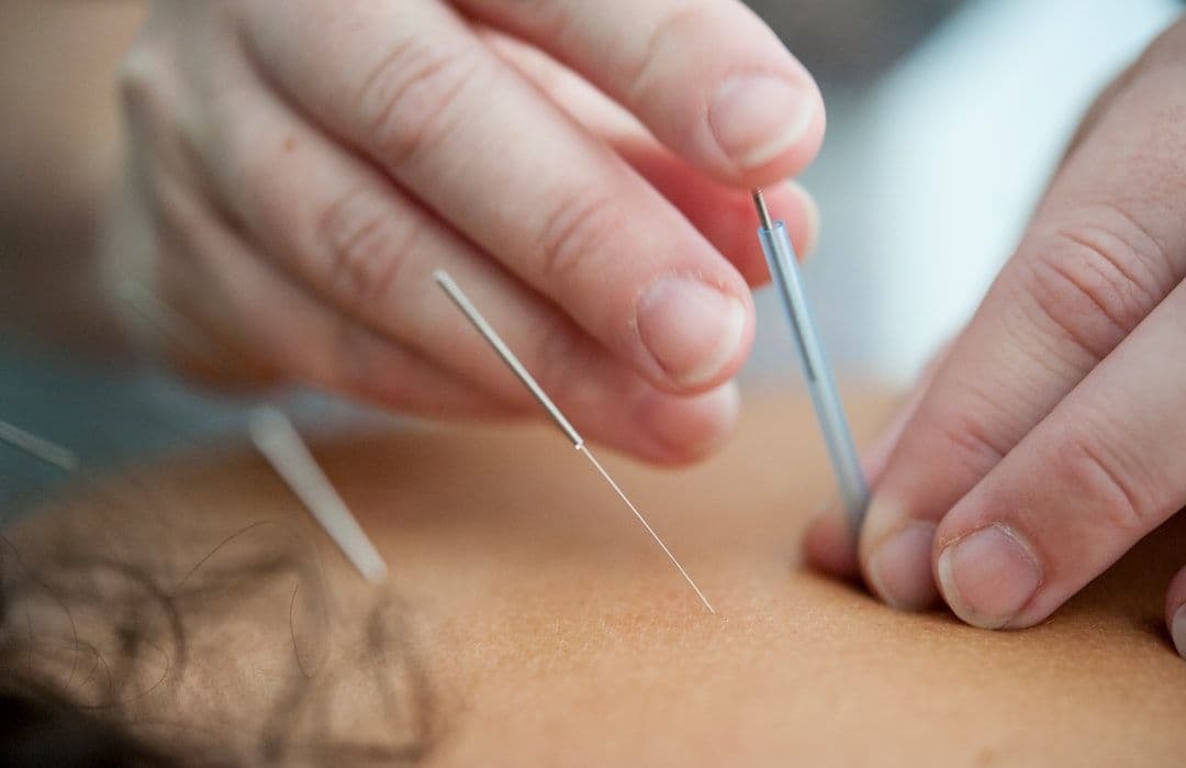 Planetary Acupuncture: Treating Earth as a Living Organism — holistic health