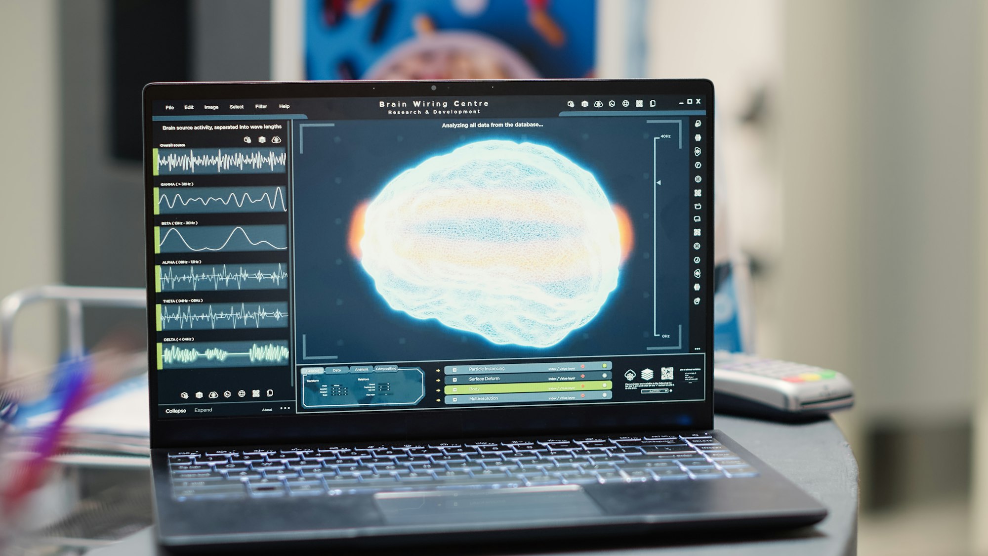 Laptop displaying human brain diagnosis